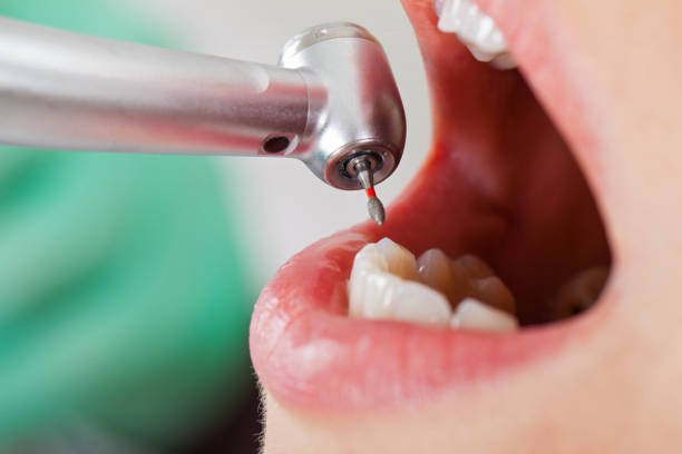 Best Orthodontic Emergency Dentist in Lmdale, PA